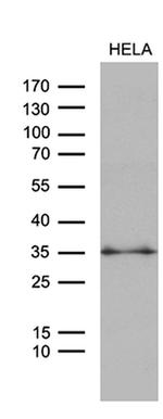 ZMAT4 Antibody in Western Blot (WB)