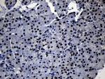 TCF12 Antibody in Immunohistochemistry (Paraffin) (IHC (P))