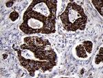TIMM8A Antibody in Immunohistochemistry (Paraffin) (IHC (P))