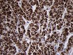 TIMM8A Antibody in Immunohistochemistry (Paraffin) (IHC (P))