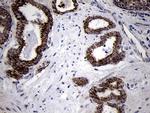 TIMM8A Antibody in Immunohistochemistry (Paraffin) (IHC (P))