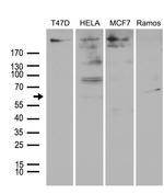 MTA3 Antibody in Western Blot (WB)