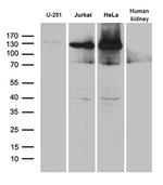 SUPT16H Antibody in Western Blot (WB)