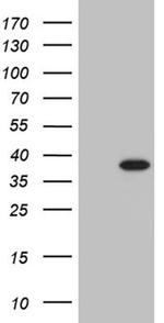 PHF20L1 Antibody in Western Blot (WB)