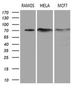 DCP1B Monoclonal Antibody (OTI1B5)