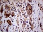 PCMT1 Monoclonal Antibody (OTI2A9)
