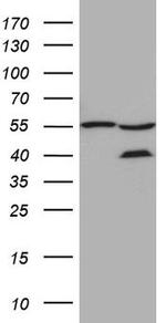 ZFYVE1 Antibody in Western Blot (WB)
