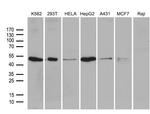 ZFYVE1 Monoclonal Antibody (OTI4H7)