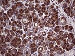SEC23B Antibody in Immunohistochemistry (Paraffin) (IHC (P))
