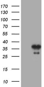 PSMD9 Antibody in Western Blot (WB)
