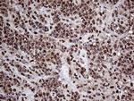 PPP4C Monoclonal Antibody (OTI2E4)