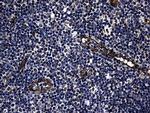 FBXO25 Antibody in Immunohistochemistry (Paraffin) (IHC (P))