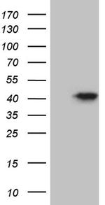 FBXO25 Antibody in Western Blot (WB)