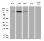 PMS1 Monoclonal Antibody (OTI5E10)