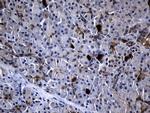 RRM2 Antibody in Immunohistochemistry (Paraffin) (IHC (P))