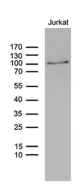 ZNF264 Antibody in Western Blot (WB)