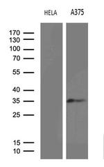 RPAIN Monoclonal Antibody (OTI4F7)