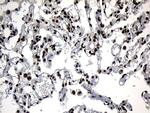 ZNF583 Antibody in Immunohistochemistry (Paraffin) (IHC (P))