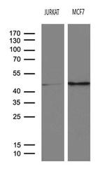 SERPINB8 Monoclonal Antibody (OTI8F10)