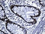 CDX1 Antibody in Immunohistochemistry (Paraffin) (IHC (P))
