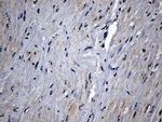CPT1B Antibody in Immunohistochemistry (Paraffin) (IHC (P))