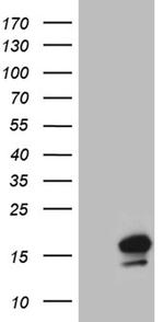 NDUFA4L2 Antibody in Western Blot (WB)