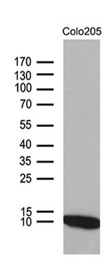 NDUFA4L2 Antibody in Western Blot (WB)