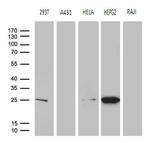 GSTZ1 Monoclonal Antibody (OTI6A10)