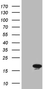 MYL1 Antibody in Western Blot (WB)