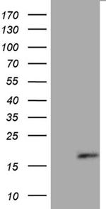 FLJ33360 Antibody in Western Blot (WB)