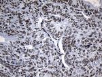 ZNF705D Antibody in Immunohistochemistry (Paraffin) (IHC (P))