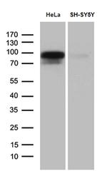 BEGAIN Monoclonal Antibody (OTI4D9)