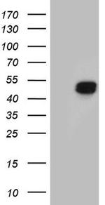 HOXD8 Antibody in Western Blot (WB)