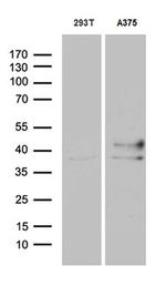 HOXD8 Antibody in Western Blot (WB)
