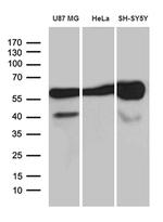 GDI1 Monoclonal Antibody (OTI7F7)