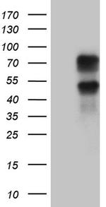 KLF11 Monoclonal Antibody (OTI4H7)