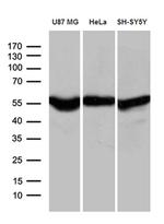 GDI1 Monoclonal Antibody (OTI8B2)