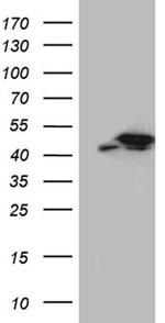 TXNL2 Antibody in Western Blot (WB)