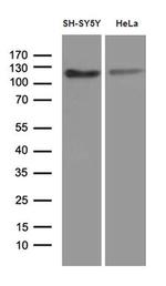 Fe65 Monoclonal Antibody (OTI3H9)