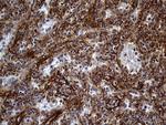 AKAP12 Antibody in Immunohistochemistry (Paraffin) (IHC (P))