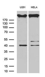 AKAP12 Antibody in Western Blot (WB)