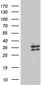 RNASE9 Antibody in Western Blot (WB)