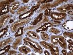 HHLA3 Antibody in Immunohistochemistry (Paraffin) (IHC (P))