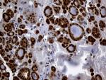 HHLA3 Antibody in Immunohistochemistry (Paraffin) (IHC (P))