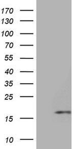 HHLA3 Antibody in Western Blot (WB)