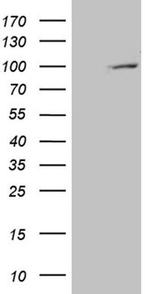 PYGM Antibody in Western Blot (WB)