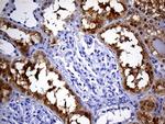PHYHD1 Antibody in Immunohistochemistry (Paraffin) (IHC (P))