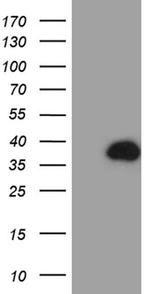 PHYHD1 Antibody in Western Blot (WB)