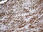 SPANXB1 Monoclonal Antibody (OTI1E11)