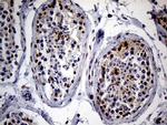 SPANXB1 Antibody in Immunohistochemistry (Paraffin) (IHC (P))